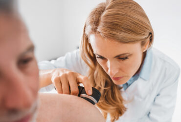 Twoja skóra pod&nbsp;kontrolą – sprawdź znamię!