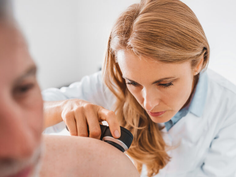 Twoja skóra pod&nbsp;kontrolą – sprawdź znamię!